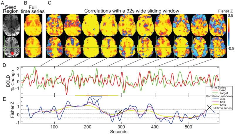 BOLD Dynamics Figure 1